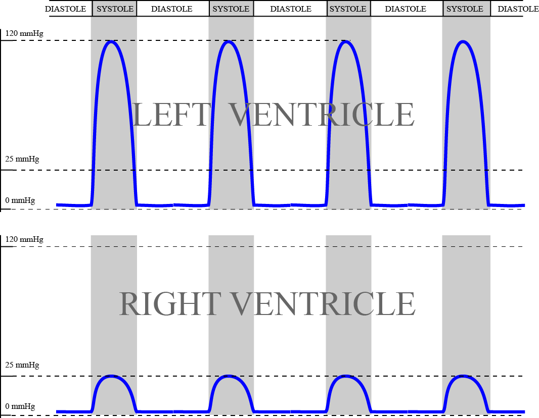 Differences in ventricular pressures between right and left cardiac ventricles